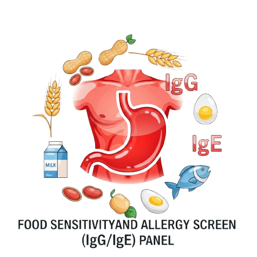 Food Sensitivity & Allergy Screen (IgG/IgE)