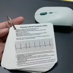 ECG Rhythms & Arrhythmias Pocket Guide Card