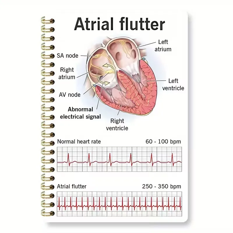 ECG Rhythm Chart & Heartbeat Monitoring Spiral Notebook